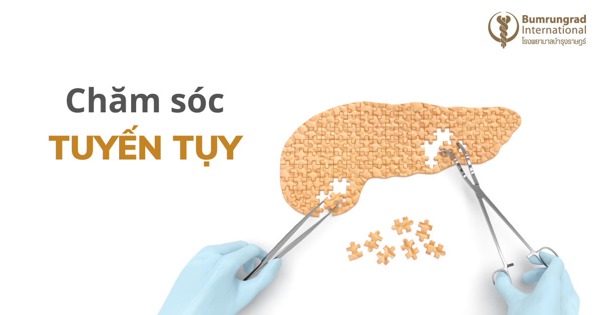 Phương pháp chứa tuyến tụy khỏe mạnh: Bí quyết giữ gìn sức khỏe hiệu quả