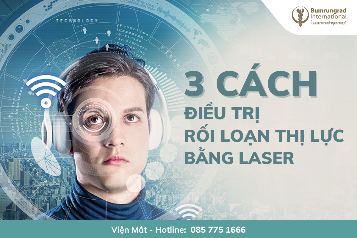 3 cách để điều trị rối loạn thị lực bằng laser