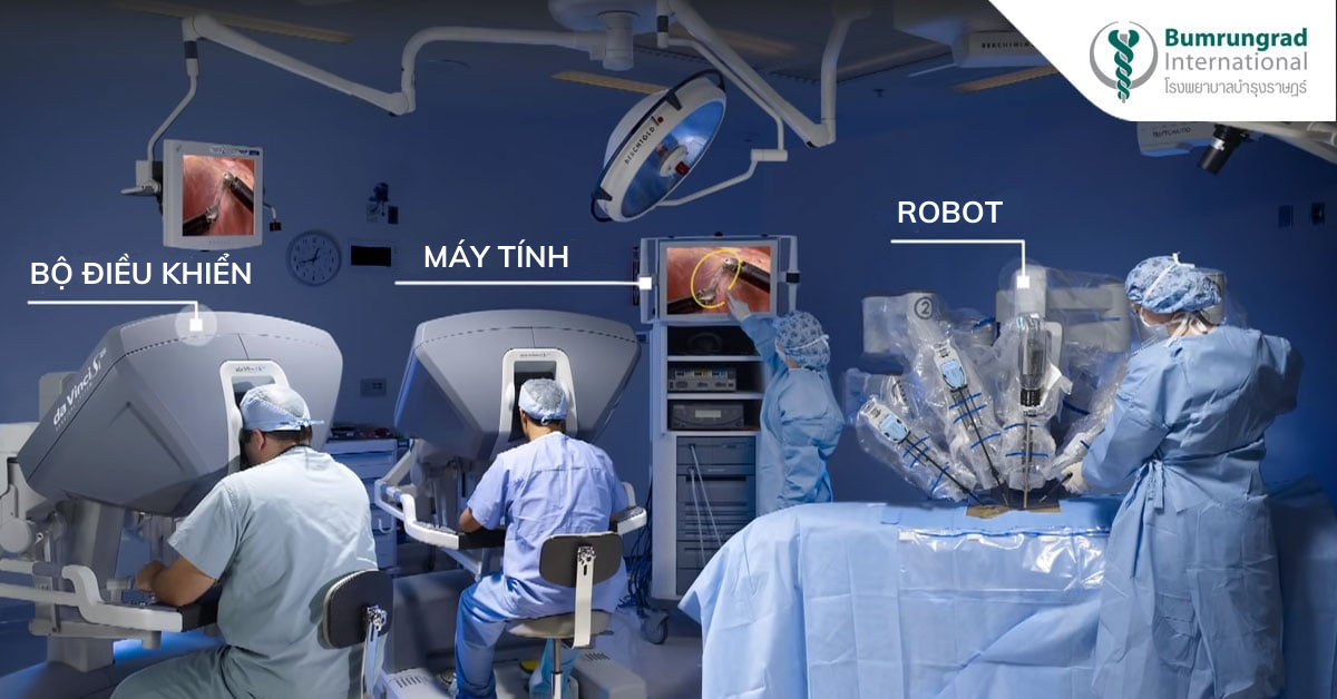 Robot hỗ trợ phẫu thuật, một giải pháp thay thế mới cho phẫu thuật sỏi mật