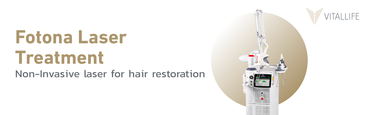 Điều trị bằng Laser Fotona Laser không xâm lấn để phục hồi tóc