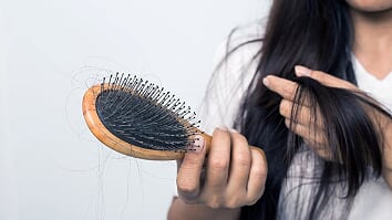 Rụng tóc - Nguyên nhân cơ bản và các lựa chọn điều trị hiệu quả