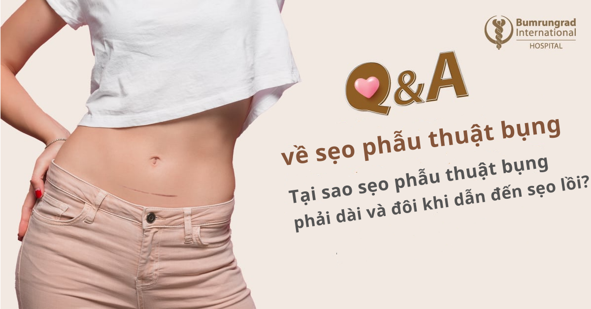 Hỏi & Đáp về sẹo phẫu thuật bụng