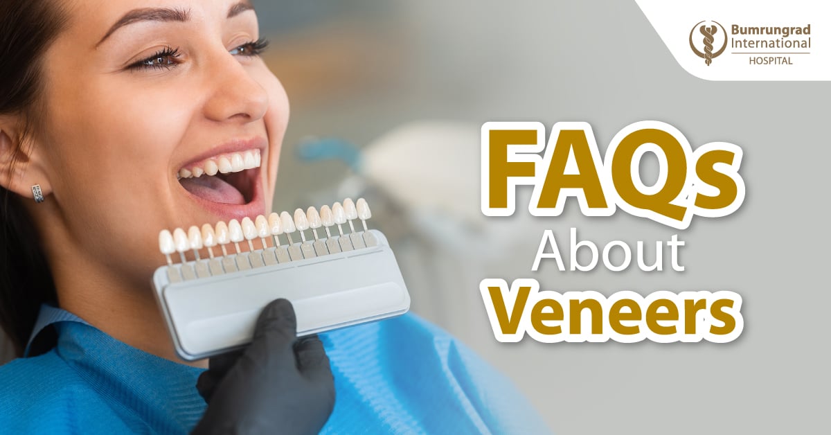 Câu hỏi thường gặp về Veneers