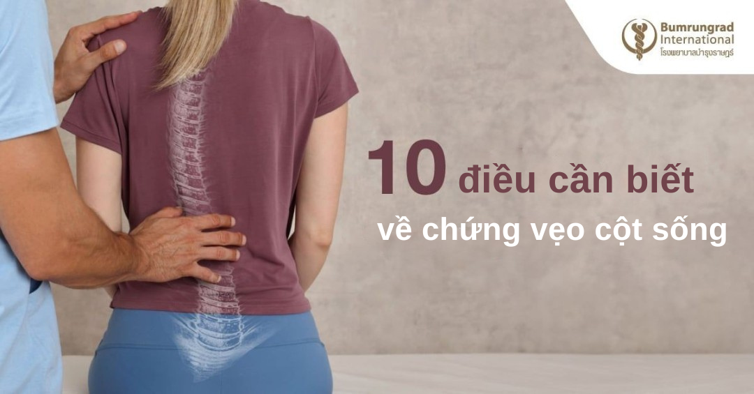 10 điều cần biết về chứng vẹo cột sống