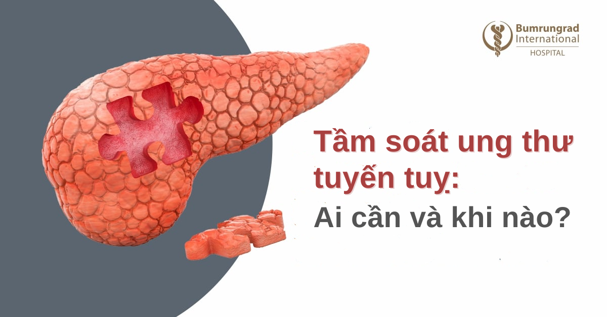 Tầm soát ung thư tuyến tụy: Ai cần và khi nào?