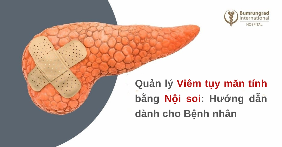 Quản lý Viêm tụy mãn tính bằng Nội soi: Hướng dẫn dành cho Bệnh nhân