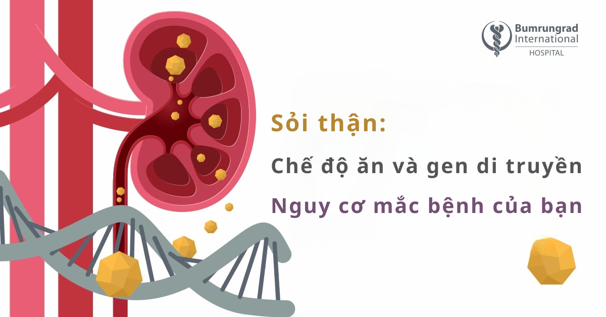 Sỏi thận: Chế độ ăn và gen di truyền - Nguy cơ mắc bệnh của bạn