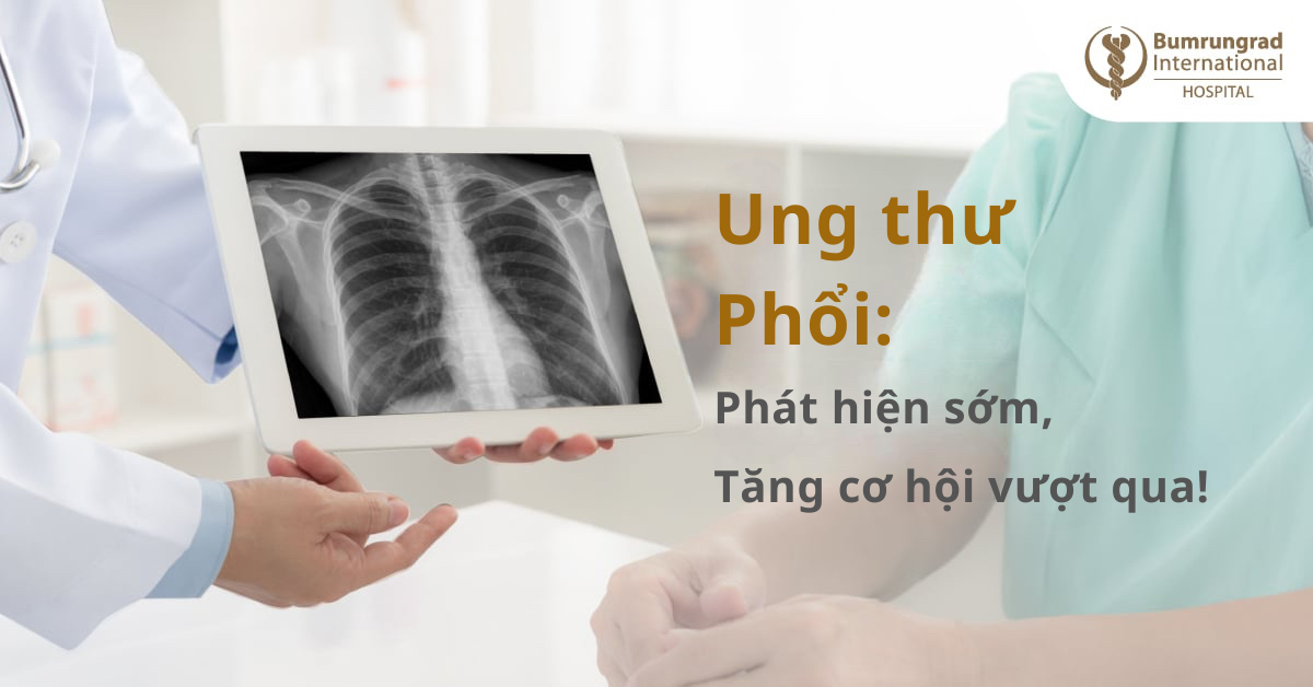 Ung thư phổi: Phát hiện sớm, tăng cơ hội vượt qua