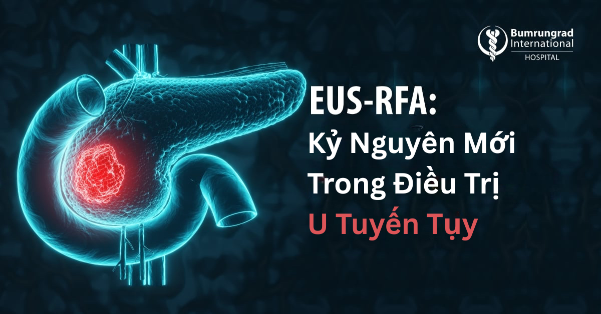EUS-RFA: Kỷ Nguyên Mới Trong Điều Trị U Tuyến Tụy