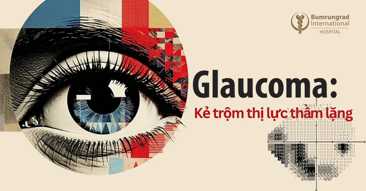 Glaucoma: "Kẻ trộm thị lực thầm lặng"