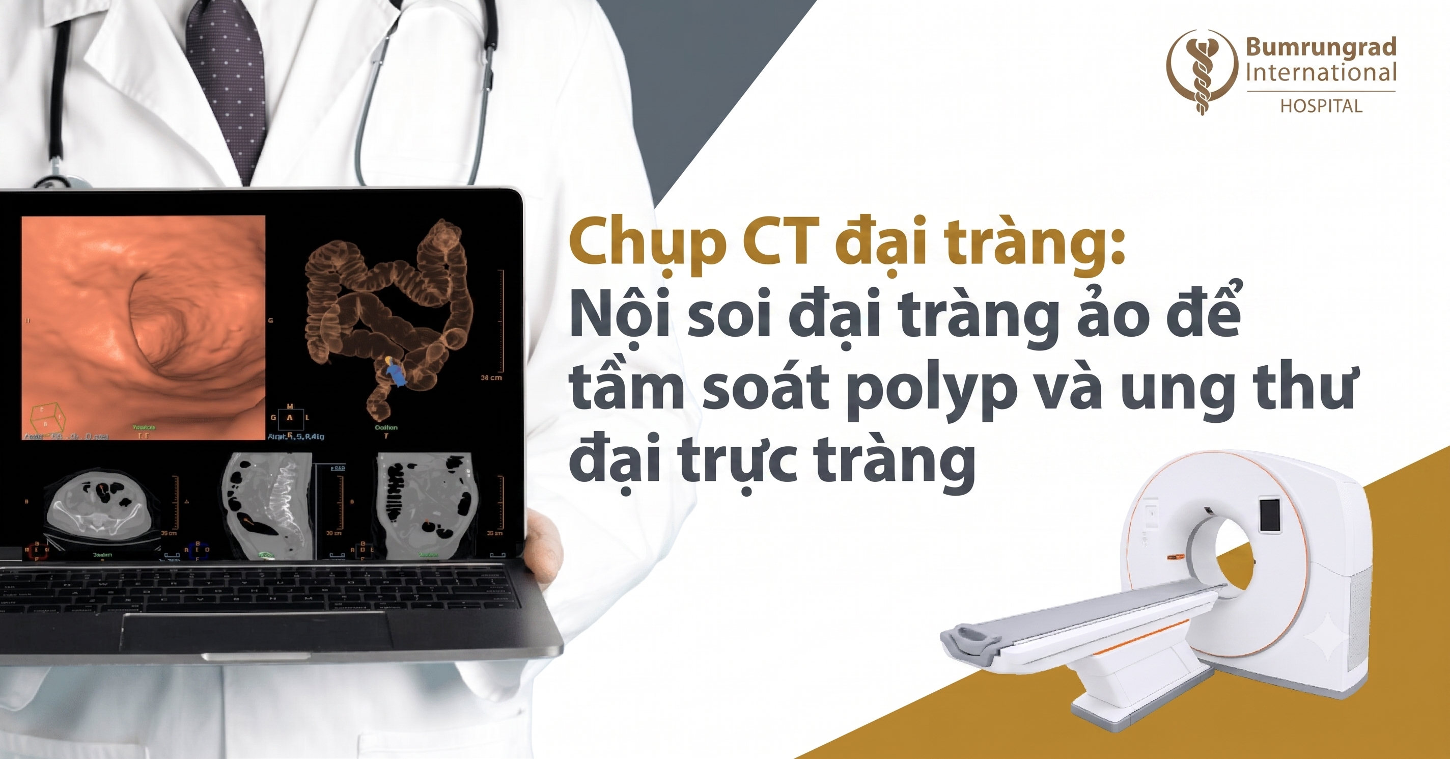 Chụp CT đại tràng: Nội soi đại tràng ảo để tầm soát polyp và ung thư đại trực tràng